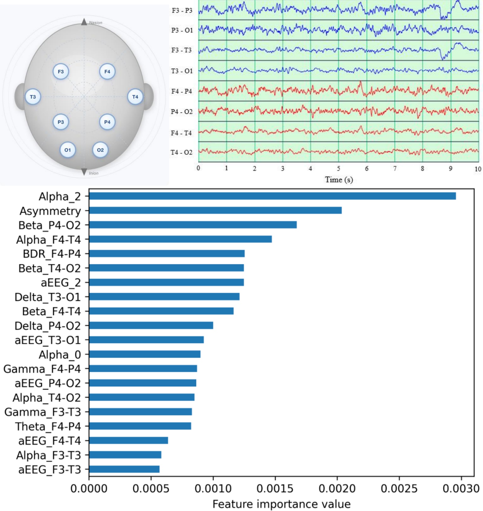 Machine learning models for intraoperative EEG ischemia detection in carotid endarterectomy